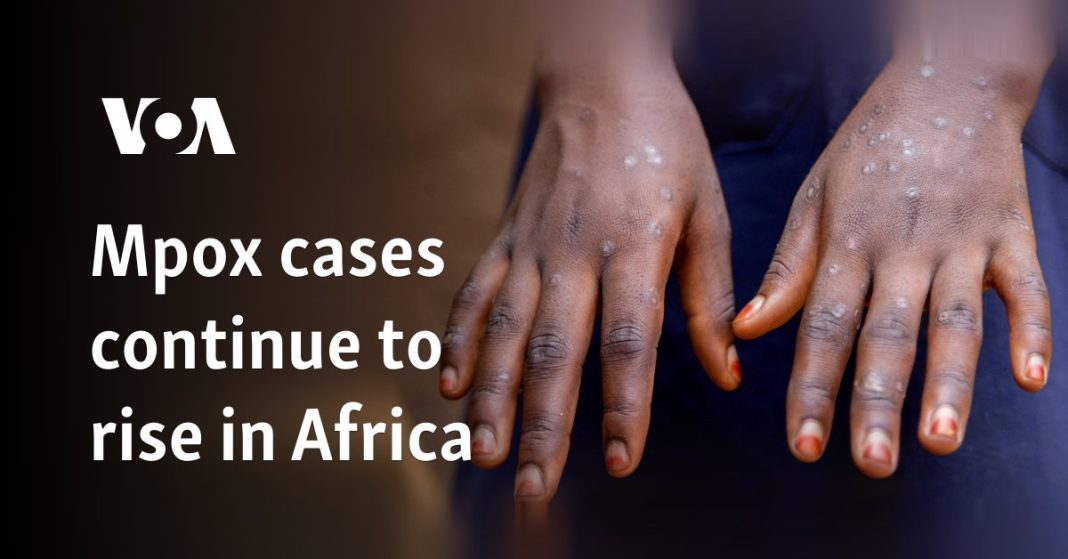 Los casos de Mpox siguen aumentando en África
