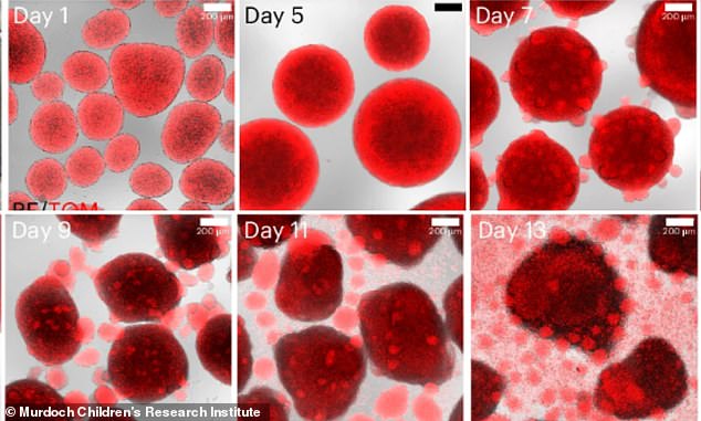 Un equipo del Instituto de Investigación Infantil Murdoch ha creado células madre sanguíneas cultivadas en laboratorio que son similares a las de los humanos, y se ha demostrado que sobreviven más allá de una placa de Petri.