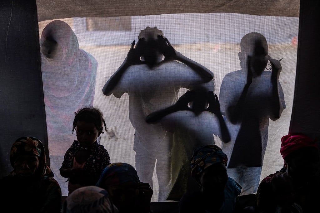 Children who fled the war in Sudan look in to a nutrition clinic at a refugee centre in Renk, South Sudan, in February 2024. (LUIS TATO / AFP)