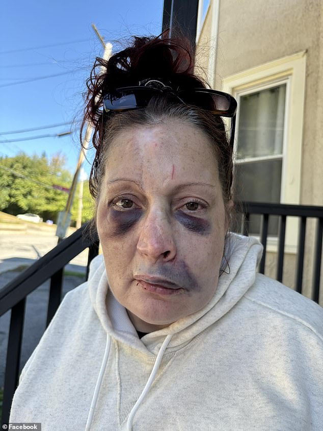 Melanie Russell de Fitchburg, Massachusetts, quedó magullada y ensangrentada por invasores de su casa el jueves por la tarde.