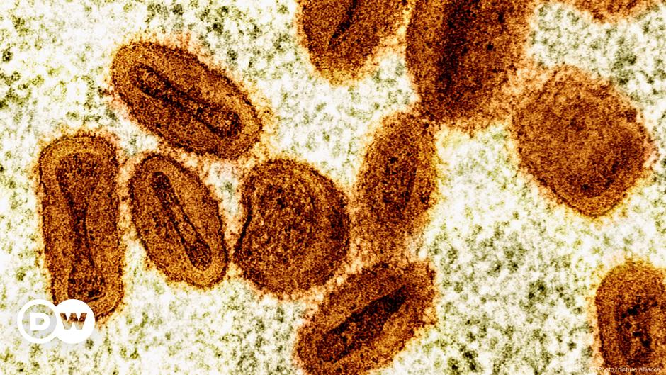 Alemania detecta el primer caso de mpox variante Ib
