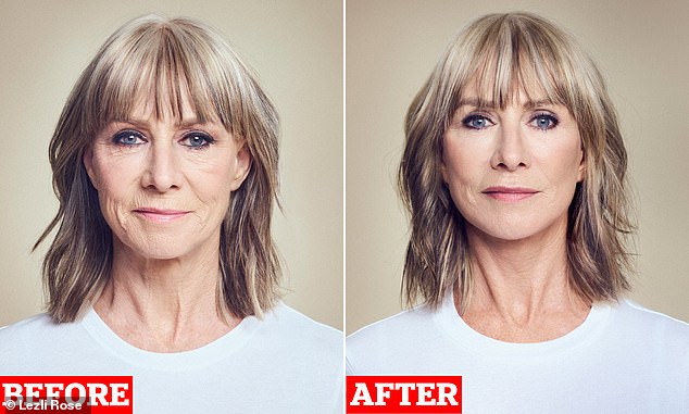 La diseñadora de High Street Karen Millen, de 63 años, fotografiada antes y después de su operación de estiramiento facial que se había realizado en la Clínica Cadogan en Chelsea, al oeste de Londres.