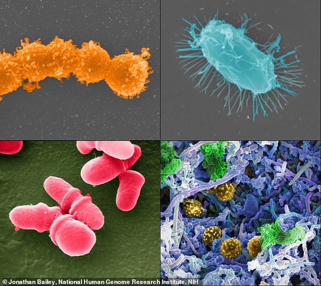 Los investigadores descubrieron que los microbios (diminutos seres vivos demasiado pequeños para verlos sin un microscopio) consumen sustancias químicas de los productos de limpieza para sobrevivir. En el sentido de las agujas del reloj, desde arriba a la izquierda: Streptococcus, biopelícula microbiana de especies mixtas del cuerpo humano, Bacillus y Malassezia lopophilis.