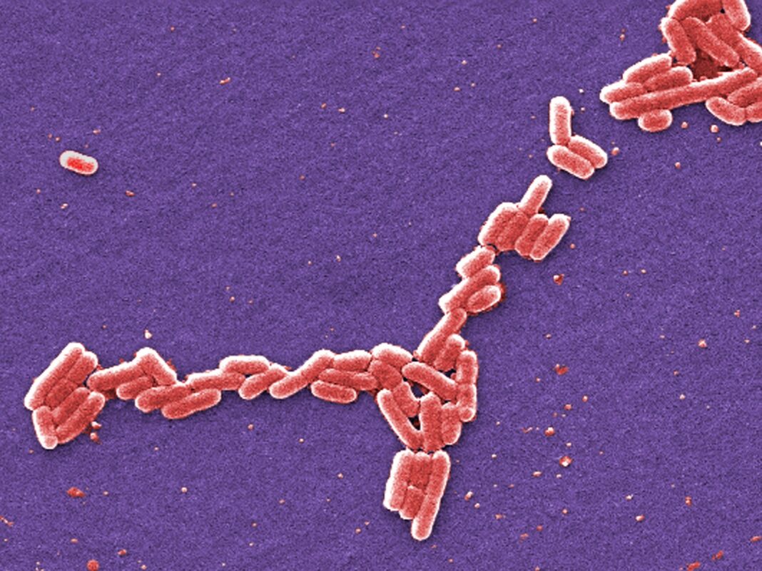 ¿Por qué se retiró del mercado la carne molida en EE. UU. por posible contaminación con E. coli?
