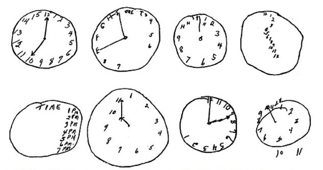 La prueba de dibujo del reloj se basa en que el paciente recuerde cómo es la esfera de un reloj, una habilidad conocida como función ejecutiva, que implica cómo planificamos, organizamos y completamos tareas.