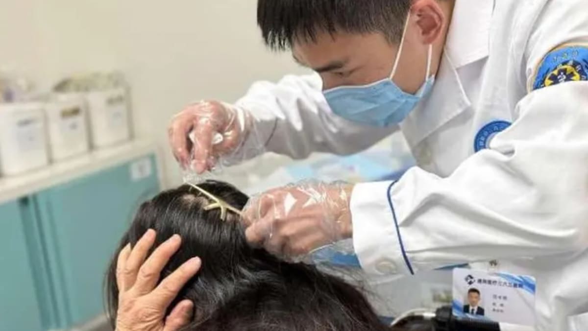 Claw de cabello de metal perfora la cabeza de la mujer después del accidente de tráfico en China
