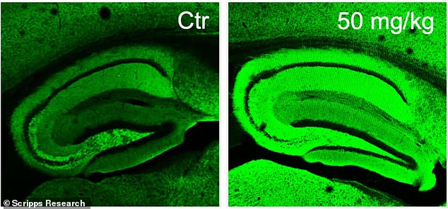 En experimentos con ratones, los científicos compararon un cerebro de Alzheimer (izquierda) con los tratados con Diacca, apareciendo como el color verde más intenso (derecho) debido al mayor número de sinapsis neuronales, conexiones entre las células nerviosas que subyacen al aprendizaje y la memoria