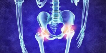 Osteoartritis: el estudio de genes encuentra nuevos objetivos farmacológicos y opciones de tratamiento