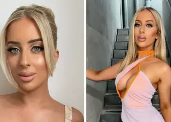 ¿Qué trabajo cosmético ha tenido realmente Jamie de MAFS Australia?