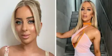 ¿Qué trabajo cosmético ha tenido realmente Jamie de MAFS Australia?