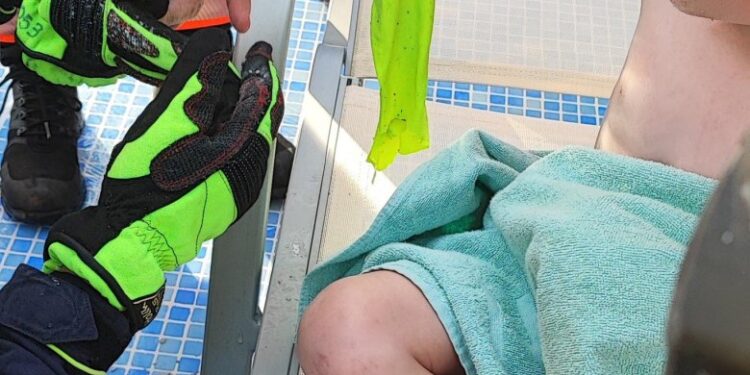 El brazo de un niño atrapado en un filtro de piscina, siendo rescatado.