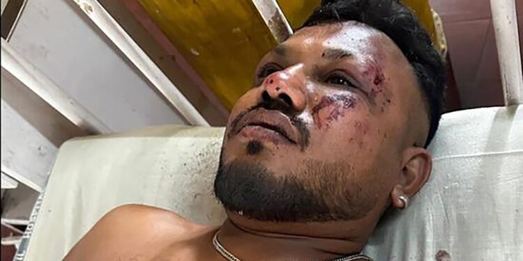 Un hombre con lesiones faciales se encuentra en una cama de hospital.