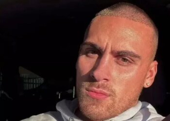 La transformación Ben de Love Island después de su trasplante de cabello de £ 3000