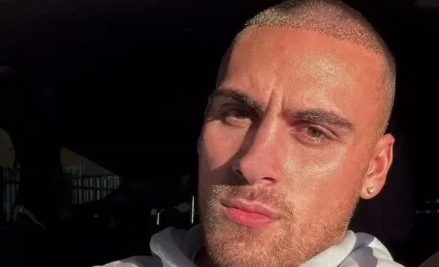 La transformación Ben de Love Island después de su trasplante de cabello de £ 3000