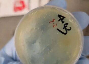 Plato de Petri con material biológico.