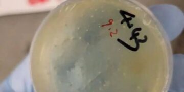 Plato de Petri con material biológico.