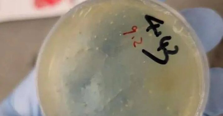 Plato de Petri con material biológico.