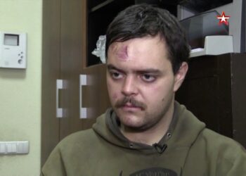 Aiden Aslin, un luchador británico para Ucrania, con una herida en la cabeza.