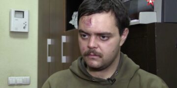 Aiden Aslin, un luchador británico para Ucrania, con una herida en la cabeza.