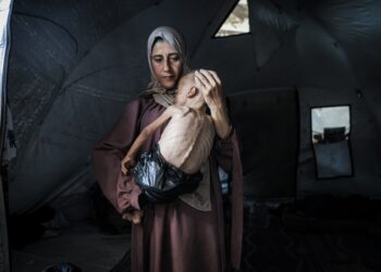 Niño desnutrido sostenido por su madre en una tienda de campaña.