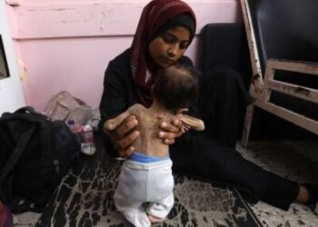 Yasmine, una madre palestina de 22 años, sostiene a su desnutrida hija de 2 meses, adolescente, mientras esperan tratamiento en el Hospital Nasser en Khan Younis en la Franja del Sur de Gaza el 24 de julio de 2025. Más de 100 organizaciones de ayuda y grupos de derechos humanos advirtieron que el hambre de masas se estaba extendiendo en Gaza.