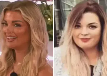 Love Island's Helena's impactante antes y después de las fotos