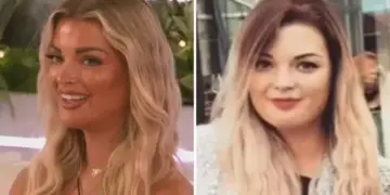 Love Island's Helena's impactante antes y después de las fotos