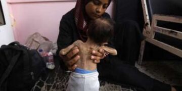 Yasmine, una madre palestina de 22 años, sostiene a su desnutrida hija de 2 meses, adolescente, mientras esperan tratamiento en el Hospital Nasser en Khan Younis en la Franja del Sur de Gaza el 24 de julio de 2025. Más de 100 organizaciones de ayuda y grupos de derechos humanos advirtieron que el hambre de masas se estaba extendiendo en Gaza.