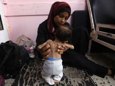 Yasmine, una madre palestina de 22 años, sostiene a su desnutrida hija de 2 meses, adolescente, mientras esperan tratamiento en el Hospital Nasser en Khan Younis en la Franja del Sur de Gaza el 24 de julio de 2025. Más de 100 organizaciones de ayuda y grupos de derechos humanos advirtieron que el hambre de masas se estaba extendiendo en Gaza.