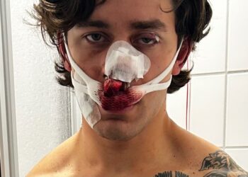 Hombre con lesiones faciales graves y vendajes empapados de sangre.