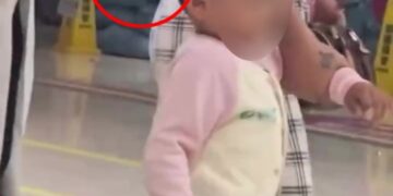 Niño pequeño con cuchillo en la cabeza que llega al hospital.