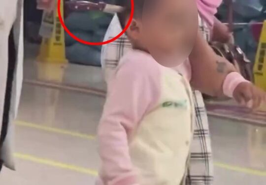 Niño pequeño con cuchillo en la cabeza que llega al hospital.