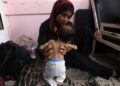 Yasmine, una madre palestina de 22 años, sostiene a su desnutrida hija de 2 meses, adolescente, mientras esperan tratamiento en el Hospital Nasser en Khan Younis en la Franja del Sur de Gaza el 24 de julio de 2025. Más de 100 organizaciones de ayuda y grupos de derechos humanos advirtieron que el hambre de masas se estaba extendiendo en Gaza.