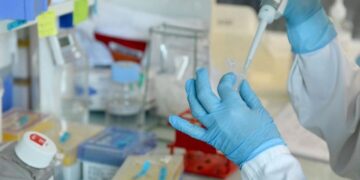 La terapia génica innovadora trata la enfermedad de Huntington por primera vez