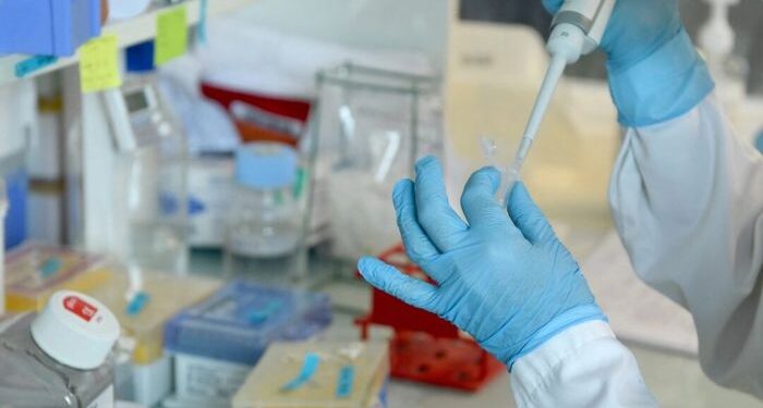 La terapia génica innovadora trata la enfermedad de Huntington por primera vez