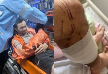 Golpes salvajes y una cabeza cortada... dentro de la capital mundial de los ataques de osos con 100 ataques y muertes récord en 2025