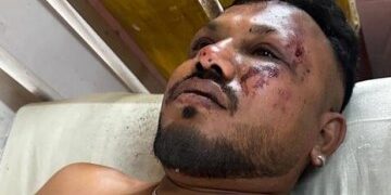 Dios me dio la vida pero me quitó la felicidad, dice el único superviviente del accidente de Air India mientras revela su trauma cinco meses después