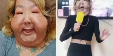 El influencer idiota apodado el Popeye ruso se enfrenta a perder AMBOS brazos después de bombearlos con un cóctel sombrío para darle unos bíceps enormes