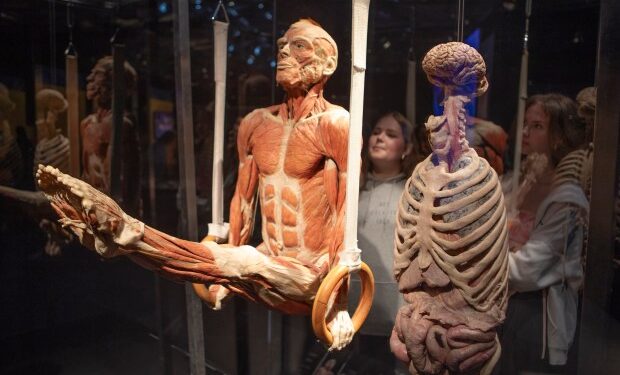 La cabeza cortada de mi padre fue encontrada en un contenedor después de que donó su cuerpo a la ciencia y fue cortada en pedazos por repugnantes 'corredores de cuerpos'