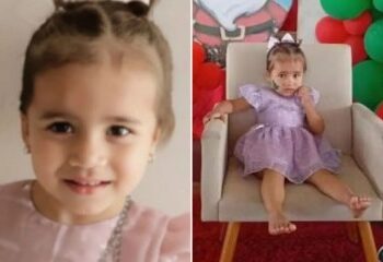 La gemela siamesa que sobrevivió a la operación de separación de su hermana muere en Navidad pocos meses después de la cirugía