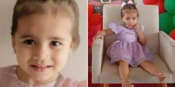 La gemela siamesa que sobrevivió a la operación de separación de su hermana muere en Navidad pocos meses después de la cirugía