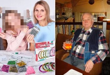 Un rico jefe de la construcción arrestado mientras una modelo lucha por su vida después de sufrir terribles heridas en la cabeza y necesitar una operación cerebral.