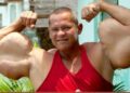 Un collage de imágenes que contiene 1 imágenes. La imagen 1 muestra a un hombre conocido como "popeye brasileño" flexionando los músculos de sus brazos extremadamente grandes