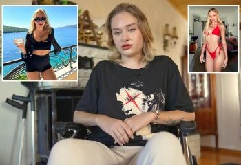 La modelo de Onlyfans, de 21 años, brutalmente atacada en la fiesta 'Porta Potty' de Dubai finalmente puede volver a caminar después de una terrible experiencia de 10 meses