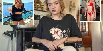 La modelo de Onlyfans, de 21 años, brutalmente atacada en la fiesta 'Porta Potty' de Dubai finalmente puede volver a caminar después de una terrible experiencia de 10 meses