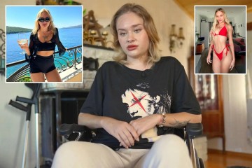 La modelo de Onlyfans, de 21 años, brutalmente atacada en la fiesta 'Porta Potty' de Dubai finalmente puede volver a caminar después de una terrible experiencia de 10 meses