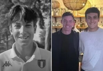 Sobreviviente del infierno de un bar suizo muestra cicatrices de terror en la cara y las manos mientras revela cómo escapó del desastre que mató a 40 personas