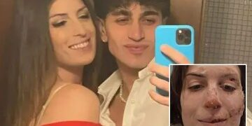 Un enorme infierno arrasa un hotel de una estación de esquí de cinco estrellas mientras cientos de huéspedes aterrorizados huyen semanas después del mortal incendio en Suiza